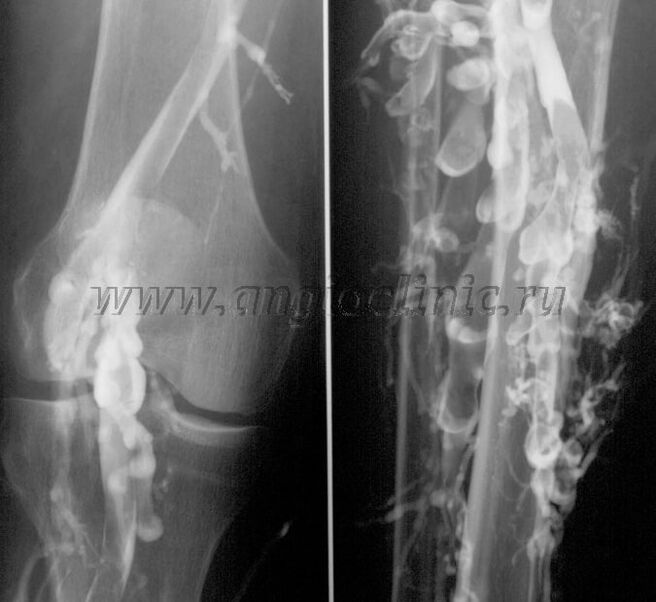 Ultraskaņas skenēšana